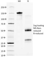 Cytokeratin 18 (KRT18) Antibody in SDS-PAGE (SDS-PAGE)