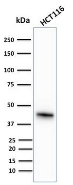 Cytokeratin 18 (KRT18) Antibody in Western Blot (WB)