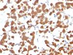 Cytokeratin 18 (KRT18) Monoclonal Antibody (C-04 (Ks18.04))