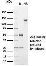 Cytokeratin 18 (KRT18) Antibody in SDS-PAGE (SDS-PAGE)