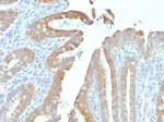 Cytokeratin 19 (KRT19) Recombinant Mouse Monoclonal Antibody (rKRT19, 799)