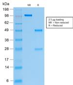 Cytokeratin 19 (KRT19) Antibody in SDS-PAGE (SDS-PAGE)
