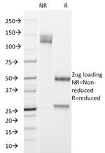 Cytokeratin 19 (KRT19) (Pancreatic Stem Cell Marker) Antibody in SDS-PAGE (SDS-PAGE)