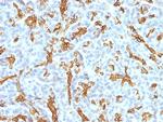 Cytokeratin 19 (KRT19) (Pancreatic Stem Cell Marker) Antibody in Immunohistochemistry (Paraffin) (IHC (P))
