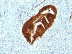 Cytokeratin 19 (KRT19) (Pancreatic Stem Cell Marker) Antibody in Immunohistochemistry (Paraffin) (IHC (P))