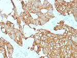 Cytokeratin 19 (KRT19) Recombinant Mouse Monoclonal Antibody (rKRT19, 800)
