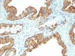 Cytokeratin 19 (Pancreatic Stem Cell Marker) Antibody in Immunohistochemistry (Paraffin) (IHC (P))