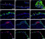 ZO-1 Antibody in Immunohistochemistry (Frozen) (IHC (F))