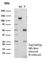 HES5/bHLHb38/Hes family bHLH transcription factor 5 Antibody in SDS-PAGE (SDS-PAGE)