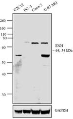 PDLIM5 Antibody in Western Blot (WB)