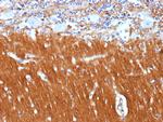 CD171/NCAM-L1 (L1 Cell Adhesion Molecule) Recombinant Rabbit Monoclonal Antibody (L1CAM/13053R)