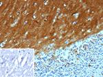 CD171/NCAM-L1 (L1 Cell Adhesion Molecule) Antibody in Immunohistochemistry (Paraffin) (IHC (P))