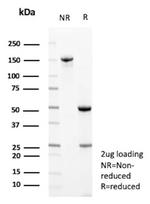 CD171/NCAM-L1 (L1 Cell Adhesion Molecule) Antibody in SDS-PAGE (SDS-PAGE)