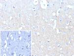 CD171/NCAM-L1 (L1 Cell Adhesion Molecule) Recombinant Rabbit Monoclonal Antibody (L1CAM/9146R)