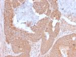 Lymphocyte Activation Gene 3 (LAG-3) (Negative Checkpoint Regulator) Monoclonal Antibody (LAG3/3261)