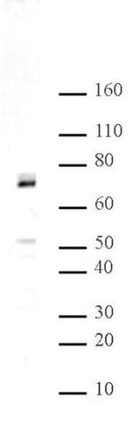 Hbo1 Antibody in Western Blot (WB)