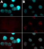 Phospho-Histone H2A.X (Ser139) Antibody in Immunocytochemistry (ICC/IF)