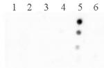 Histone H2BK120ac Antibody in Dot Blot (DB)