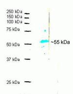 alpha Synuclein Antibody in Western Blot (WB)