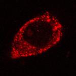 Rad52 Antibody in Immunocytochemistry (ICC/IF)
