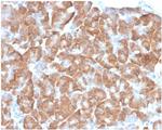 Laminin Receptor/ RPSA (Marker of Metastatic Potential) Recombinant Rabbit Monoclonal Antibody (RPSA/6332R)