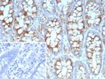 Stathmin 1/STMN1 Recombinant Rabbit Monoclonal Antibody (STMN1/9227R)