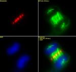 INCENP Antibody in Immunocytochemistry (ICC/IF)