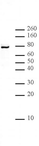LAP2 alpha Antibody in Western Blot (WB)
