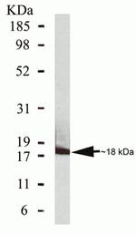 CDKN2C Antibody in Western Blot (WB)