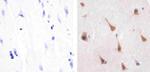 PPP2R5C Antibody in Immunohistochemistry (Paraffin) (IHC (P))