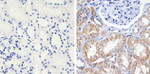 AKT2 Monoclonal Antibody (ZA006)