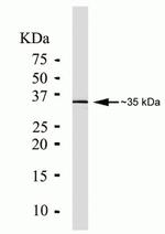 PIM1 Monoclonal Antibody (ZP003)