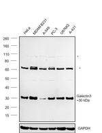 Galectin 3 Monoclonal Antibody (ZG001)