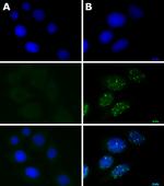 Phospho-ATM (Ser1981) Antibody in Immunocytochemistry (ICC/IF)