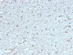 Leptin Receptor (LEPR)/Ob-R/CD295 Monoclonal Antibody (LEPR/4304)