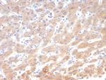 Leptin Receptor (LEPR)/Ob-R/CD295 Monoclonal Antibody (LEPR/4545)