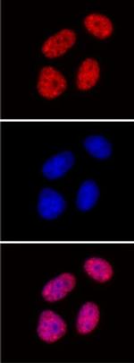 Histone H3K27me2me3 Antibody in Immunocytochemistry (ICC/IF)
