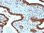 Galectin-3 (LGALS3) (Thyroid Cell Marker) Antibody in Immunohistochemistry (Paraffin) (IHC (P))