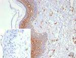 Galectin-3 (LGALS3) (Thyroid Cell Marker) Antibody in Immunohistochemistry (Paraffin) (IHC (P))