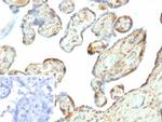 Galectin-3 (LGALS3) (Thyroid Cell Marker) Antibody in Immunohistochemistry (Paraffin) (IHC (P))