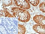 Galectin-3 (LGALS3) (Thyroid Cell Marker) Antibody in Immunohistochemistry (Paraffin) (IHC (P))
