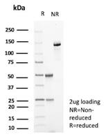 Galectin-3 (LGALS3) (Thyroid Cell Marker) Antibody in SDS-PAGE (SDS-PAGE)