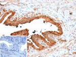 Galectin-3 (LGALS3) (Thyroid Cell Marker) Recombinant Rabbit Monoclonal Antibody (LGALS3/13233R)