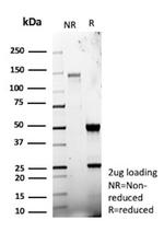 Galectin-3 (LGALS3) (Thyroid Cell Marker) Antibody in SDS-PAGE (SDS-PAGE)
