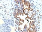 Galectin-3 (LGALS3) (Thyroid Cell Marker) Antibody in Immunohistochemistry (Paraffin) (IHC (P))
