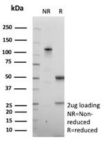 Galectin-3 (LGALS3) (Thyroid Cell Marker) Antibody in SDS-PAGE (SDS-PAGE)