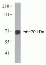 HEC1 Antibody in Western Blot (WB)