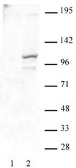 Phospho-STAT2 (Tyr689) Antibody in Western Blot (WB)