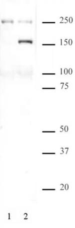 Phospho-SMC1 (Ser957) Antibody in Western Blot (WB)