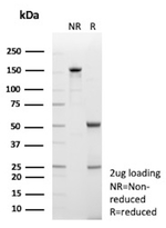 Galectin-9 (LGALS9) (Marker of T-Cell Exhaustion) Antibody in SDS-PAGE (SDS-PAGE)
